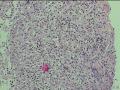 胃窦活检图7