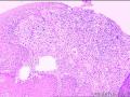 食管下段活检，请看看这些是什么细胞？急！图3