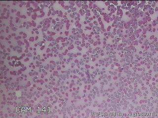 甲状腺细胞学图29