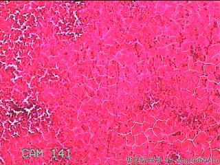 甲状腺细针穿刺涂片图29